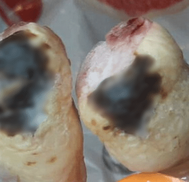 égési sérülések a bolti csirkehúsokon